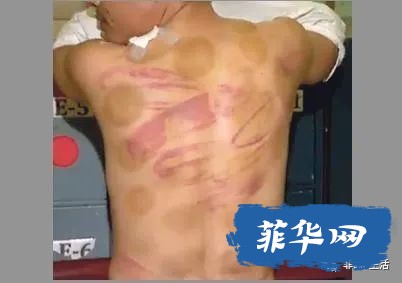菲律宾针对中国人的绑架案激增，赌场和线上菠菜相关占大半！！