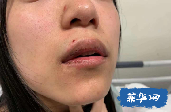 人神共愤：中国留学生街头遇袭！w2.jpg