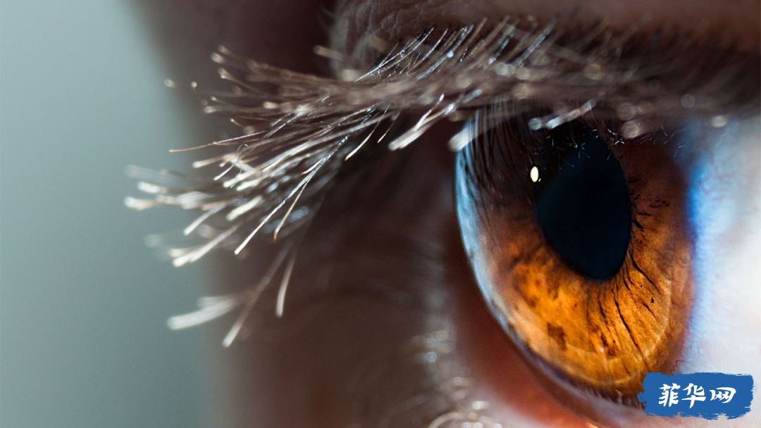 在菲律宾做近视眼手术——晶体植入的体验w11.jpg