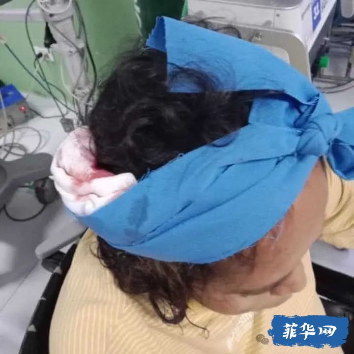 仅仅因为被催促找工作——懒癌入骨的菲律宾孽畜砍死父亲，砍伤母亲w3.jpg