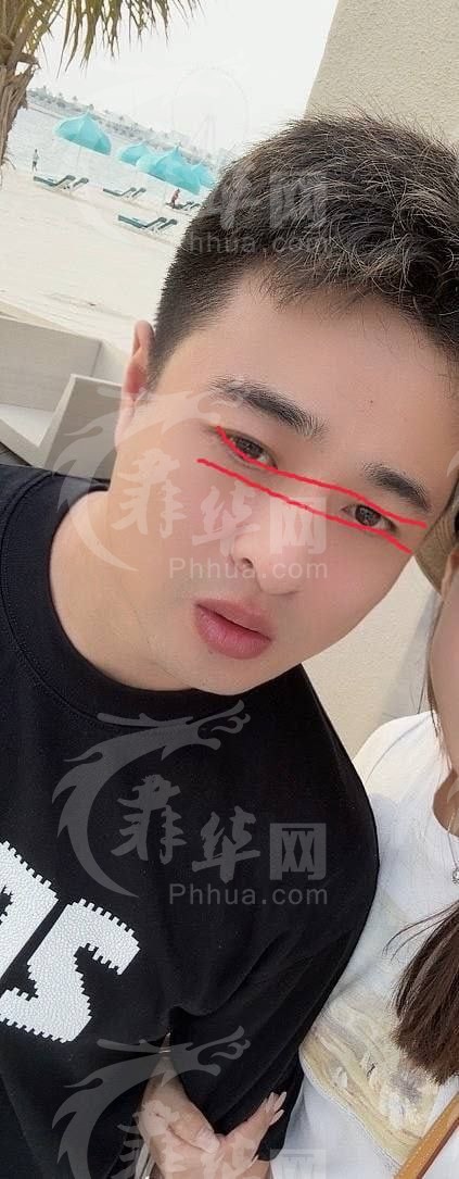 我的狗吃屎了，我的朋友说别要了，给他扔了吧，但是呢我总想给他一次改过自新的机会 ...