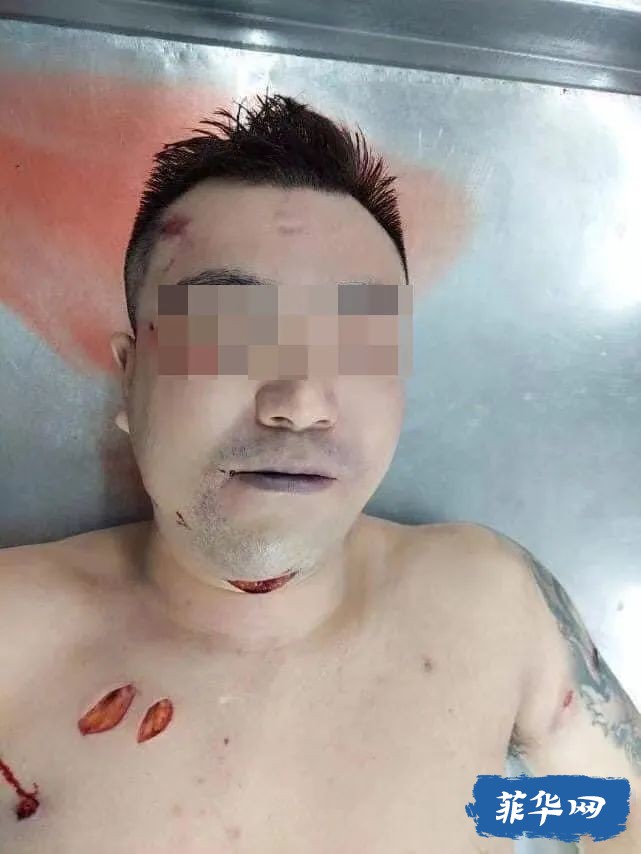 1中国人马尼拉遭绑架中枪，3余年前绑匪张小龙在附近喋血陨命w4.jpg